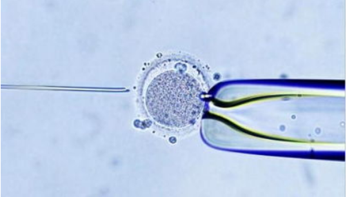 温州供卵产子包男孩 2023温州试管婴儿医院排名，附成功率及费用介绍 ‘胎囊
