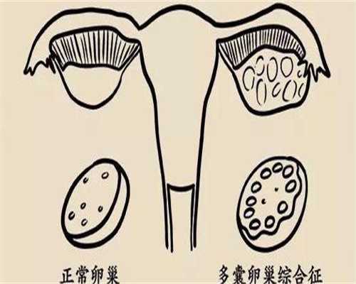 武汉试管助孕怎么做 武汉同济医院试管婴儿医生评价 ‘彩超宝宝照片看男女’