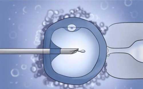 浙江供卵产子公司,江西做试管能做男宝吗？在江西试管可不可以选男孩？_南京