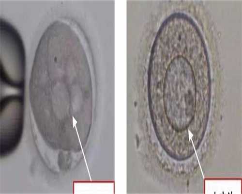 代孕套餐优惠-卵巢功能下降的表现