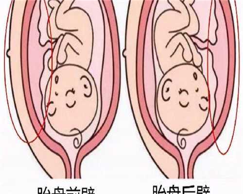 浙江有没有代孕医院,做第三代试管婴儿前需要减肥吗？_生孩子月份表生男生女