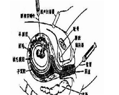 浙江做冻卵的时间周期是多久,浙江做试管婴儿需要多久准备？?