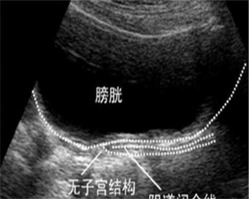 浙江HPV疫苗接种地址?,浙江圣德利生殖医学中心的地址是什么？