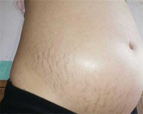 河北大学附属医院生殖科好还是保定妇幼好(潍坊妇幼和附属哪个好)