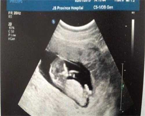 预防哺乳期乳腺炎的方法，哺乳期乳腺炎的原因