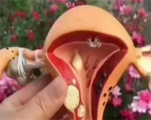 浙江代孕最好的公司,泰国试管婴儿移植后腹痛是怎么回事?_西安能做供卵吗_医