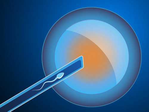 浙江啥叫三代供卵,北京哪里有助孕机构？怎么找，北京几大助孕机构各有何特