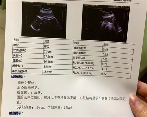 不结婚可以试管婴儿吗？