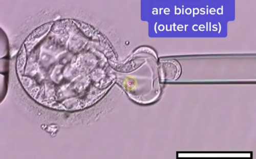 浙江靠谱代生,试管婴儿过程中 ，如何监测排卵？_上海供卵试管生子多少钱-试