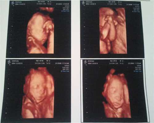 代孕包生女孩：金华市做试管婴儿哪个医院技术高？金华市试管