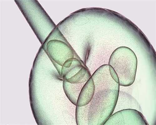 俄罗斯可以未婚做试管的