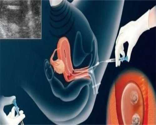 浙江省妇保院试管成功率数据解读?,浙江热门试管医院导航