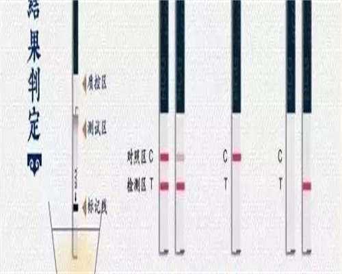 浙江代孕生完多久,正在做试管婴儿，每天注射达必佳，果纳芬已经10天了 果纳