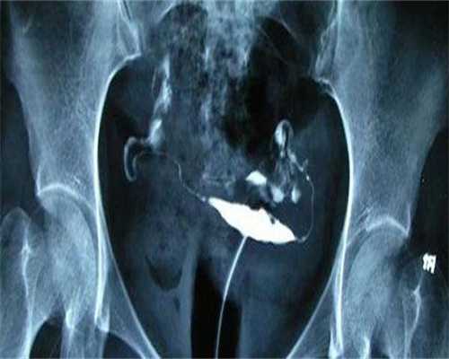 浙江专业供卵助孕,32岁做试管婴儿，2次失败，第3次终于成功，守得云开见月明